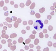 babesia
