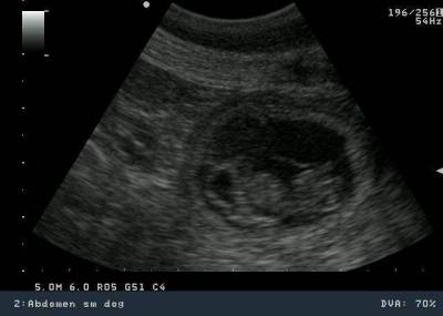 27-napos-vemhesseg-b