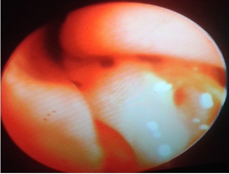 Toklász kutya orrüregében Toklász kutya orrüregében