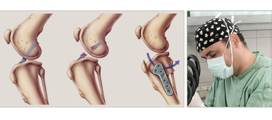 Ortopedie-ortopedia genunchiului